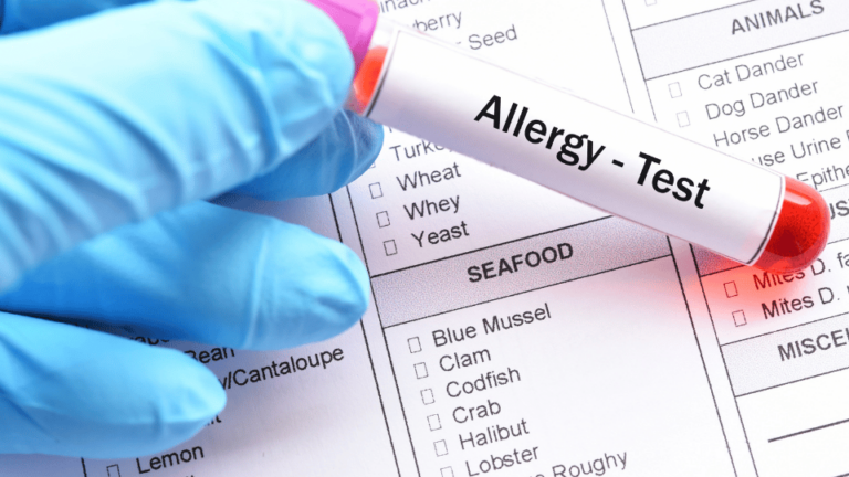 Allergy Testing Service